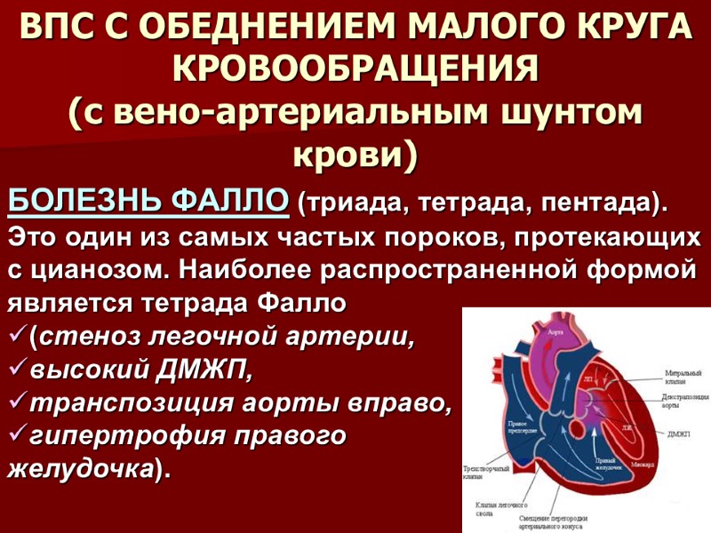 ВПС С ОБЕДНЕНИЕМ МАЛОГО КРУГА КРОВООБРАЩЕНИЯ (с вено-артериальным шунтом крови)  БОЛЕЗНЬ ФАЛЛО (триада,